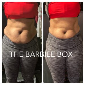 Lasor Lipo Body Sculpting